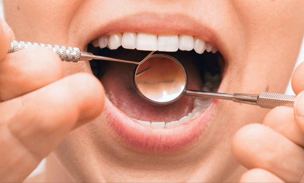 Gum disease may put people at high risk of developing some cancers