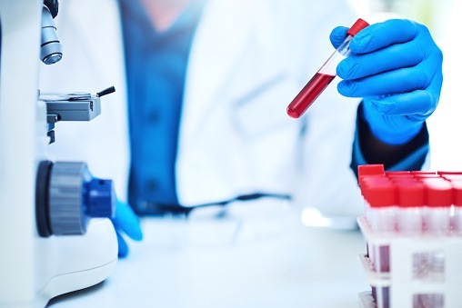 Simple blood test can detect 50+ types of cancer before any symptoms even start