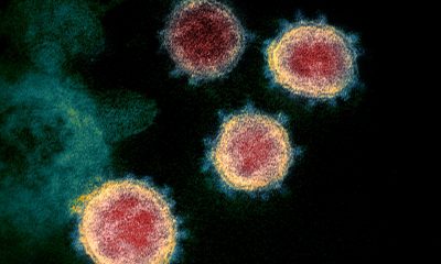 First NY case of COVID-19 Brazilian variant found in NYC resident