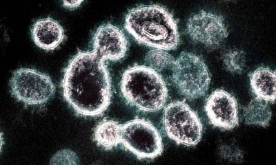 Coronavirus ‘UK variant’ now most common strain in US, CDC reports