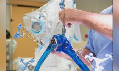 New ‘knee robot’ improving patient surgery outcomes
