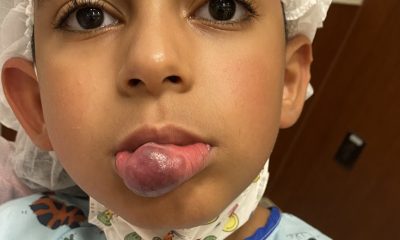 Rochester boy has life-changing surgery in NYC
