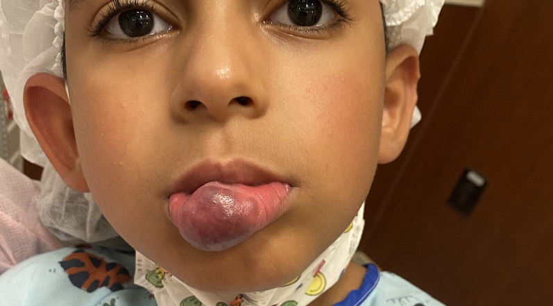 Rochester boy has life-changing surgery in NYC