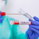 131 new COVID-19 cases reported in Monroe County