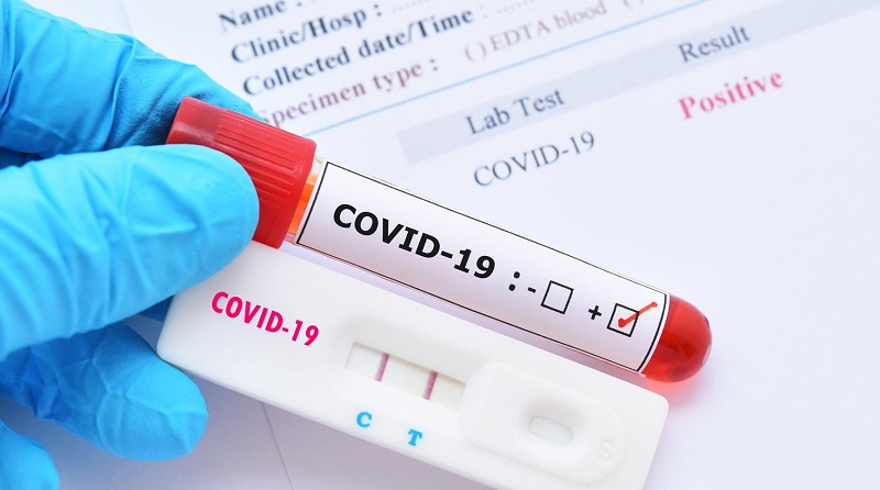 257 new COVID cases reported in Rochester Region