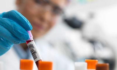 607 new COVID-19 cases in Monroe County