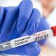 1,401 new COVID-19 cases, and 18 new deaths reported in Monroe County