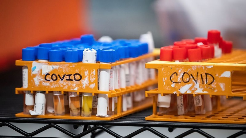 The Monroe County Department of Public Health warns of COVID exposure at youth football banquet The Monroe County Department of Public Health warns of COVID exposure at youth football banquet