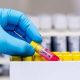 319 new COVID-19 cases reported in Monroe County