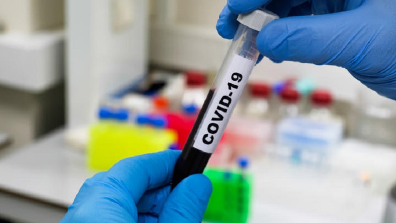 Monroe County with average of 400 new COVID cases per day